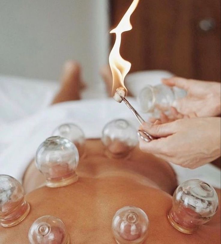 Hijama sèche