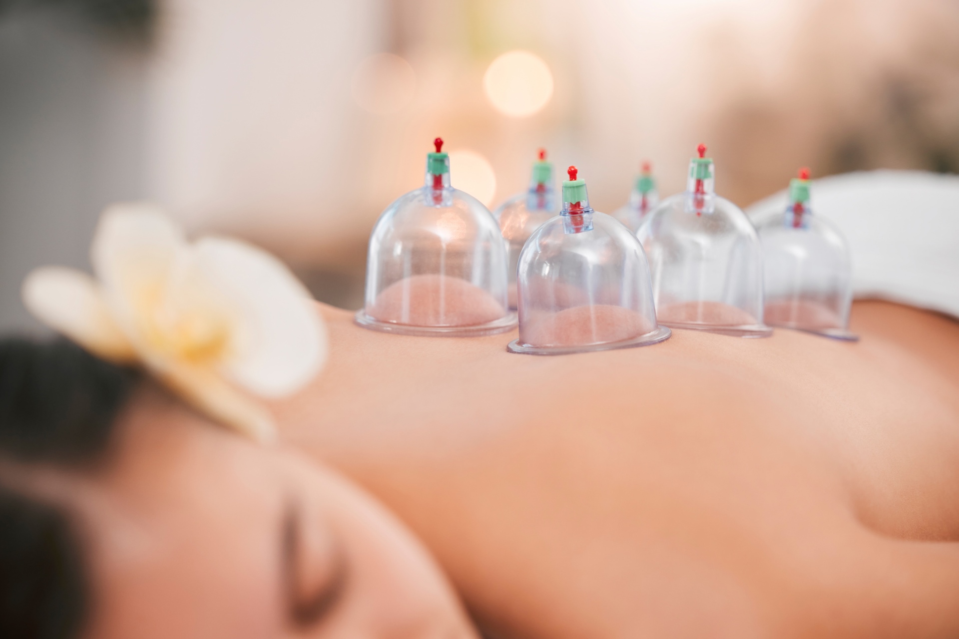 Hijama humide